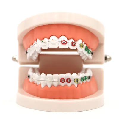 Modèle de Traitement Orthodontique Dentaire avec Ortho Métal Céramique Support Rapide Fil d'Arc