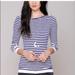 Free People Tops | - Womens Free People Black And White Stripped Too | Color: Black/White | Size: S