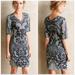 Anthropologie Dresses | Anthropologie Baraschi Floral Lace Pattern Dress | Color: Black/White | Size: 2