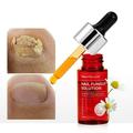 Fungal Nail Renewal - Maximum Strength Nail Fungus Treatment Toe Fungus Nail Treatment