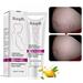 Natural Mild Non-irritating Mango Stretch Mark Cream For Pregnancy Repair Scar Slack Line Abdomen Stretch Marks Cream