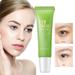 TureClos 15G Green Tea Eye Cream to Reduce Dark Circles and Tighten Skin Eye Moisturizer for All Skin Types