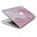 Marble Pattern hard shell case for Macbook Pro 13 -A1989/A2159/A1706/A1708/A1278/Pro 13 Retina-A1425/A1502/Air 13 -A1932/Air 13 -A2179/Air 13 -A1466/A1369/Pro 13 -A2251/2289