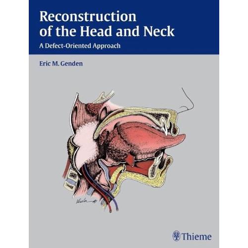 Reconstruction of the Head and Neck - Eric M. Genden