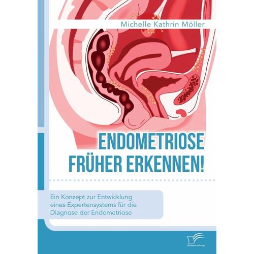 Endometriose früher erkennen! Ein Konzept zur Entwicklung eines Expertensystems für die Diagnose der Endometriose – Michelle Kathrin Möller