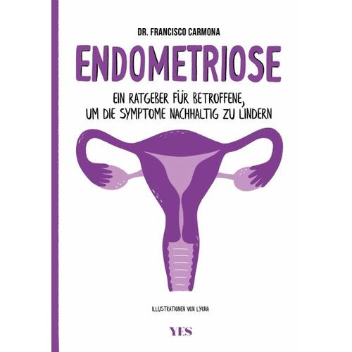 Endometriose – Francisco Carmona