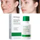 Sérum pour le visage à l'acide salicVAC rétrécit les pores contrôle de l'huile élimine l'acné