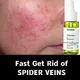 Repair Facial Redness Serum Instant Spider Vein Remove Sensitive Skin Sooth Anti Redness Rosacea