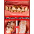 Tooth Decay Repair Repair All Tooth Decay Cavities and Protect Teeth Whitening Teeth Dental Lab