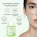 Rdeuod Serum for Face Anti Aging Facial Essence Acne Removing Essence Liquid 15ML Facial Care Oil Control Fade Acne Marks And Repair Skin Essence multicolor