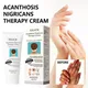 EELHOE Acanthosis Nigricans Therapy Cream Cream for Underarm Arm Knee Joint Black Moisturizing and