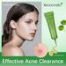 Kokovifyves Beauty Products Sale Acne Removing Cream Herbal Acne Removing Cream Desalinating Acne Marks Removing Blackhead Acne Repairing Acne Removing Cream