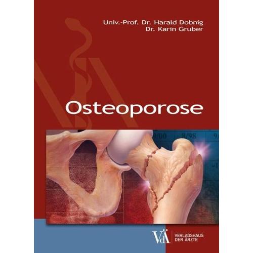 Osteoporose – Karin Gruber, Harald Dobnig
