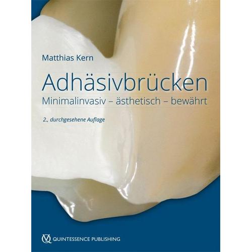 Adhäsivbrücken – Matthias Kern