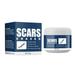 Scar Acne Cream Pimple Treatment Cream Scar Removal Cream- Stretch Marks Remover Cream For All Skin Types New And Old Scar