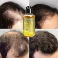 Unisex Anti Hair Loss Ginger Shampoo Hair Growth Products Shampoo Against Hair Loss Mild Treatment