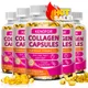 Kenofor 120 Hydrolyzed Collagen Capsules - Support Skin & Joint & Hair & Nail Health - Collagen