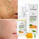 Turmeric Freckle Whitening Serum Dark Spot Correction Essential Oil Anti-Wrinkle Reduce Acne Marks