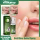 Oral Ulcer Relief Spray Treatment Canker Sore Swollen Gum Pharyngitis Relieve Mouth Pain Natural