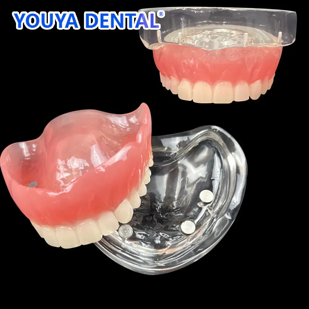 Dental Obere Overdenture Zähne Modell Magnetische Adsorption Abnehmbare Überlegene Unterkiefer Für Student Zahnarzt Demo Studie Lehren Image