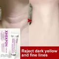 Neck Anti-Wrinkle Cream Reduce Neck Fine Lines Collagen Whitening Skin Aloe Anti-Aing Cream