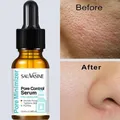 Pore Removing Serum Shrinking Large Pores Minimizing Pore Face Tightening Repairing Facial Pore