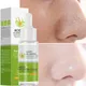 Lactic Acid Pore Shrinking Face Serum Acne Treatment Oil Control Moisturizing Relieving Dryness