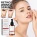 Kokovifyves Retinol Wrinkle Serum Retinol Serum for The Face Against Ageing 2-Minute Wrinkle Serum Skin Care for Sensitive Skin AntiAgeing Skin Care Serum 30ML