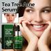 Fankiway Nourishing & Moisturizing Facial Serum Tea Oil Serum Prone Sensitive Skin Care Face Serum To Cystic Redness Relief Pimples Dark Spots Niacinamide Facial Moisturizer 30ml