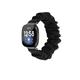 Smart Watch Band for Fitbit Versa 3 / Fitbit Sense Fabric Smartwatch Strap Multilayer Braided Sport Band Scrunchie Band Replacement Wristband