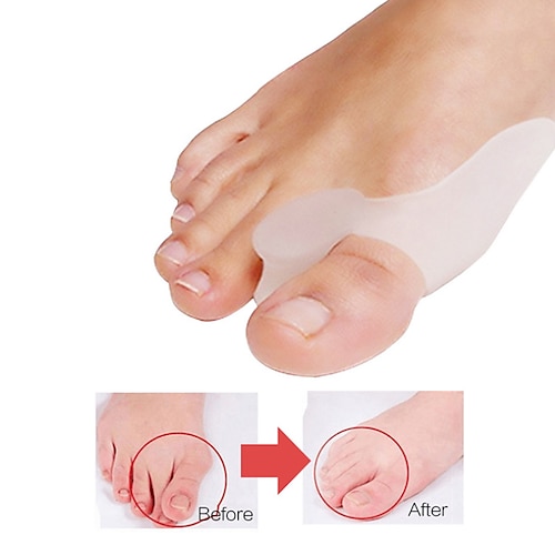 1 Paar Zehentrenner aus Silikon, Fuß, Hallux Valgus, Korrektur, Knochen, Ektropium, Einsteller, Zehen, Außengerät, Fußpflege, Gel, Ballenzeh, großer Zehentrenner, Spreizer, lindert Fußschmerzen Image