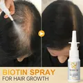 PURC Biotin Hair Fast Growth Serum Oil Ginger Anti Hair Loss Scalp Treatment Grow Products Beauty