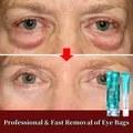 7 Days Anti-Wrinkle Eye Cream Get Rid Of Dark Circles Lighten Fine Lines Remove Eye Bags Puffiness