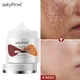 Dark Spot Remover Face Cream Niacinamide Whitening Black Dots Removal Pore Shrink Cream Facial