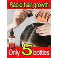 Fast Hair Growth Oil Baldness Repair Hereditary Hair Loss Postpartum Hair Loss Seborrheic Hair Loss