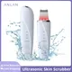 ANLAN Low Noise Ultrasonic Skin Scrubber IXP5 Waterproof Light Therapy EMS Face Lifting Ultrasonic