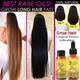 Hair Growth Serum Anti Preventing Hair Loss Alopecia Liquid Damaged Hair Repair Growing Faster