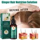 Fast Growth And Care Essential Oil Natural Ginger Hair Regrowth Products Serum Hair Care Loss Series