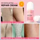 Body Whitening Creams Removal Chicken Skin Treatment Keratosis Pilaris Lotion Bumpy Rough Pore Spots