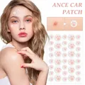 Hydrocolloid Acne Pimple Patch 36 Counts Cute Cat Paws Shaped Acne Absorbing Cover Patch Invisible