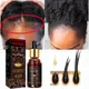 Alopecia Hair Treatment for Women Hairloss Hair Oil Growth Tool Spray Caffeine for Treatment Dry