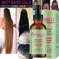Hair Growth Essential Oil Rosemary Mint Hair Strengthening Oil Nourishing Treatment for Dry Mielle