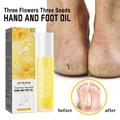 SUMDUINO Three Flowers Hand And Foot Essential Oil Repairs Chapped Dry Itchy Moisturizing Skin On Hands And Feet 10ml - Foot Cream for Dry Feet