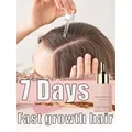 Sérum à croissance rapide des cheveux traitement anti-chute de cheveux amincissement prévention