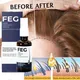 Best Hair Growth Product FEG Hair Growth Spray Serum For Hair Loss Treatment 50ml