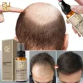 PURC Ginger Hair Growth Spray Anti Hair Loss Scalp Treatment Fast Regrowth Thicken Care Serum Hair