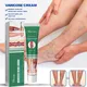 Varicose Vein Treatments Cream Effective Relieve Legs Dilated Vasculitis Phlebitis Natural Formula