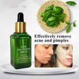 ELES Acne Treatment Green Tea Essence Anti-acne Essence Mild And Non-irritating Anti-acne Anti-acne Print Essence