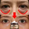 Instant Eye Bags Remove Eye Cream Anti Fat Particles Dark Circles Under-Eye Puffiness Firming