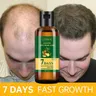 Ginger Hair Growth Essential Oil Anti-loss Hair Regrowth Serum Fast Growth Prevent Baldness